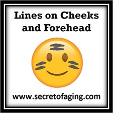 Lines on Cheeks and Forehead