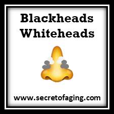 Blackheads and Whiteheads by Secret of Aging