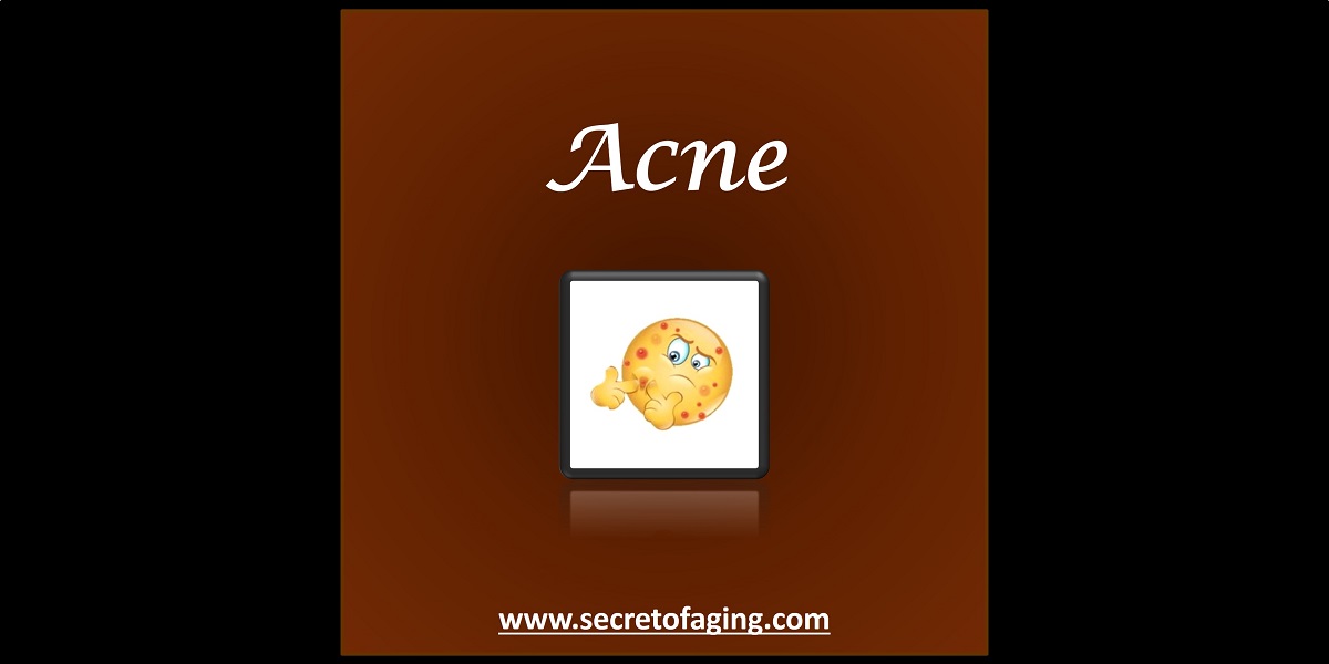 Acne Conditions by Secret of Aging