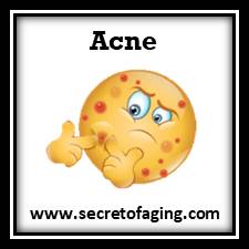 Acne Condition Secret of Aging
