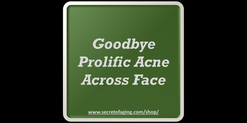 Goodbye Prolific Acne Across Face Recipe by Secret of Aging
