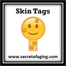 Prevent Skin Tags with Ultimate Prolific Acne Recipe by Secret of Aging