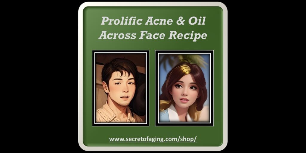 Prolific Acne and Oil Across Face Recipe Art by Secret of Aging