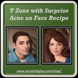 T Zone with Surprise Acne on Face Image by Secret of Aging