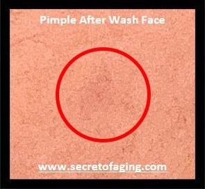 Blown Up Pimple After Wash Face by Secret of Aging