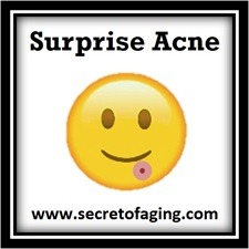 Surprise Acne by Secret of Aging