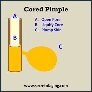 Cored Pimple with Solution by Secret of Aging