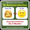 Hormonal Acne Recipe by Secret of Aging