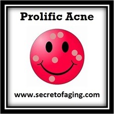 Prolific Acne Icon by Secret of Aging