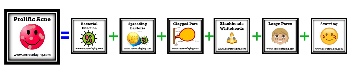 Ultimate Prolific Acne Logic by Secret of Aging