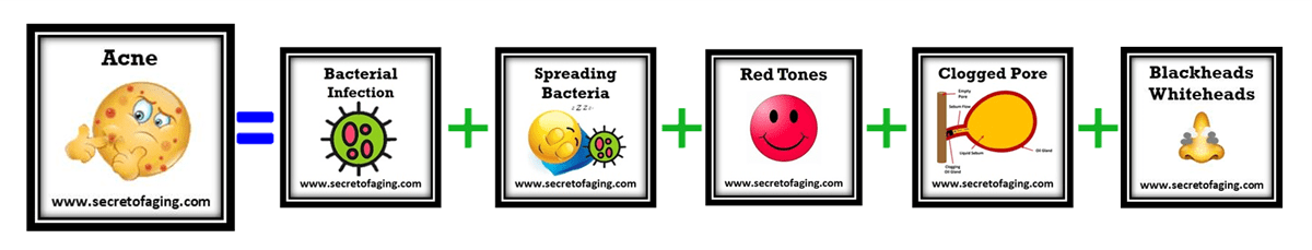 Prolific Acne Logic by Secret of Aging