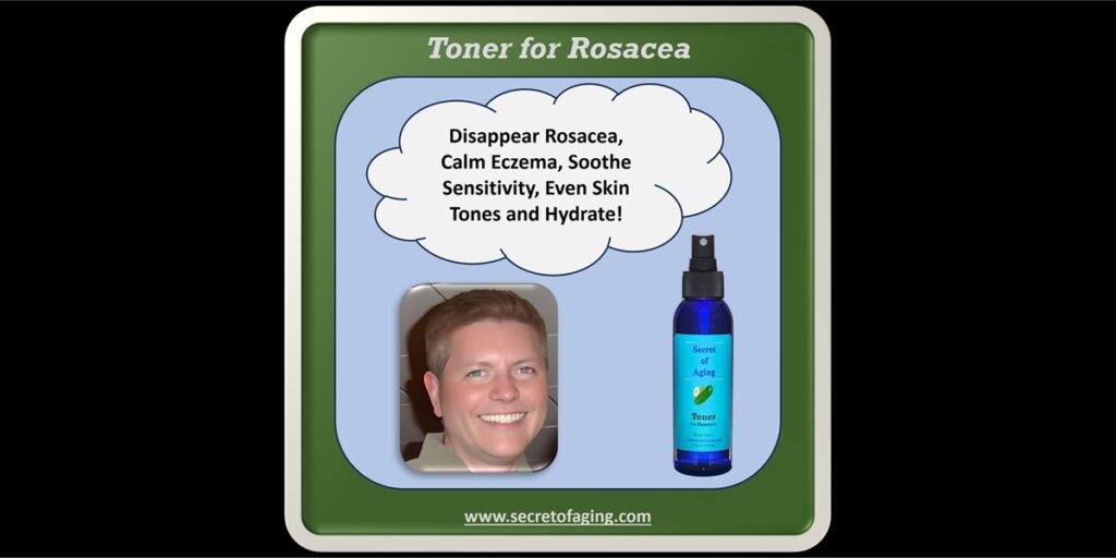 Toner for Rosacea by Secret of Aging