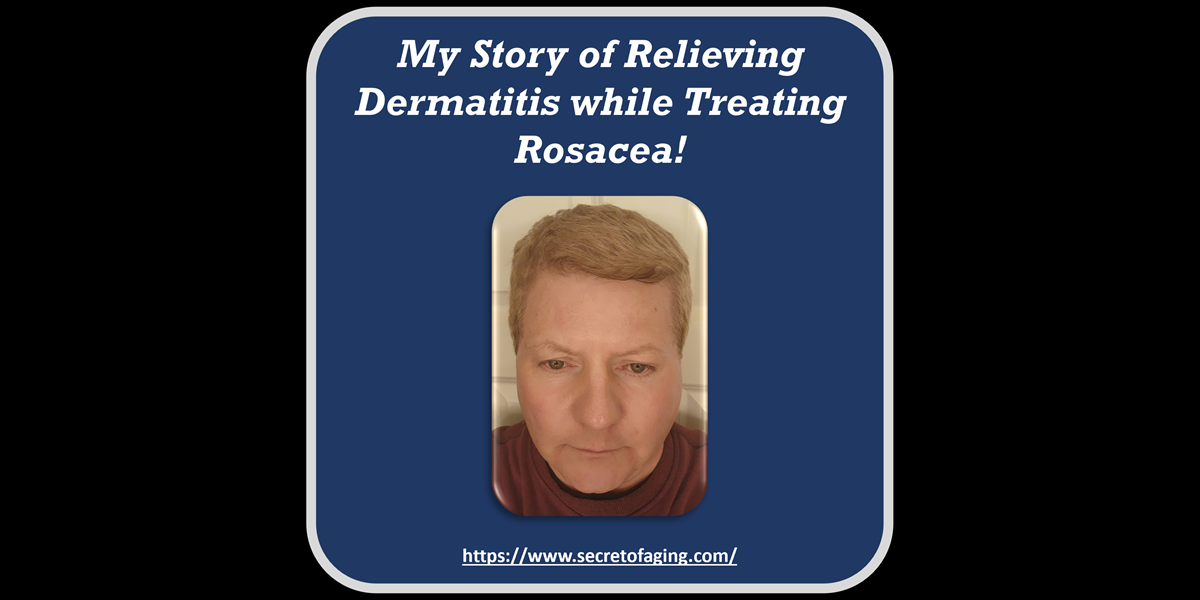 My Story of Relieving Dermatitis while Treating Rosacea